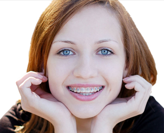 Teeth Whitening